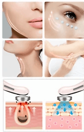 Photon Skin Beautifier - Image 2